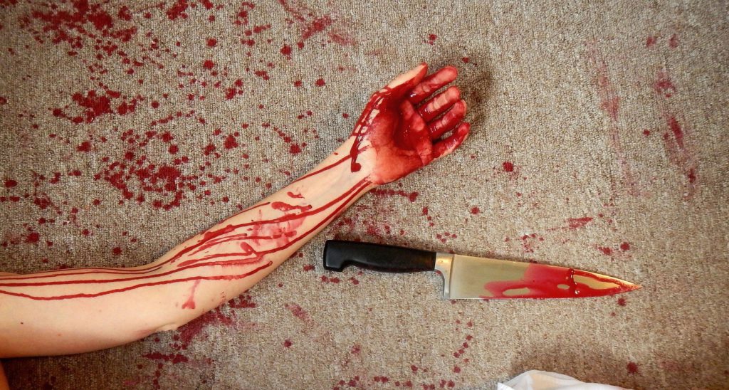 Muslim Man’s Hand Cut Off When Attackers Saw ‘786’ Tattooed on His Arm